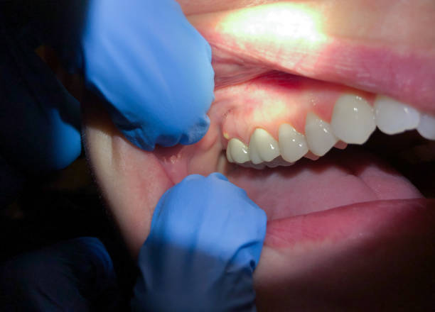 Best Knocked-Out Tooth Emergency  in Davis, OK