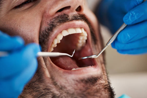 Best Emergency Tooth Extraction  in Davis, OK