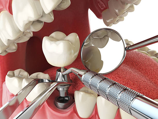 Best Urgent Tooth Repair  in Davis, OK